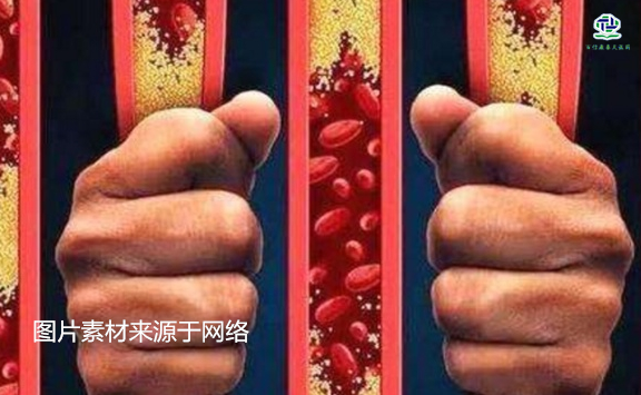 不想給血管“添堵”，盡量少吃以下這些東西，或許能讓腦梗離遠些  